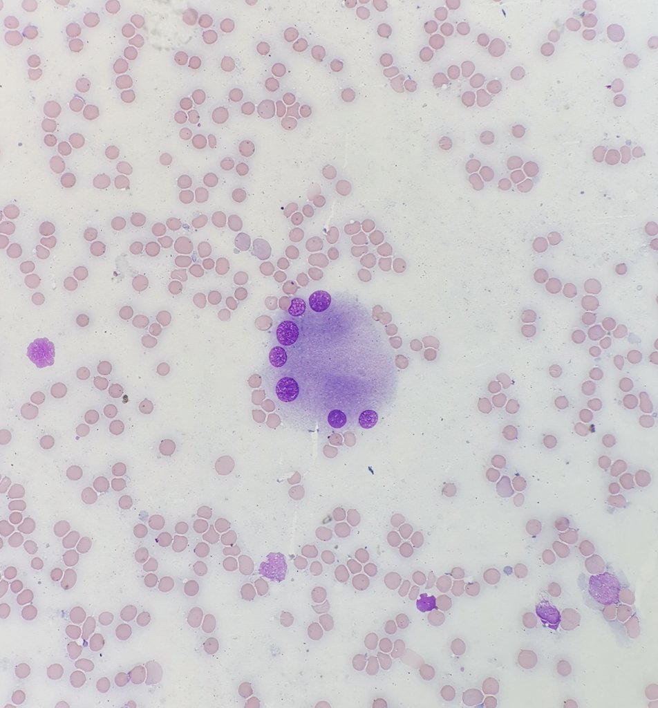 "Wondering who can be more dysplastic than me" -- the mega.