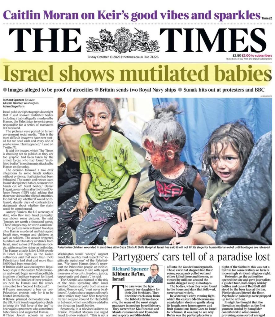 timand2037's tweet image. Cynicism. Murdoch's @thetimes shows images "alleged to be proof of Hamas atrocities", but they are injured #Palestinian children.