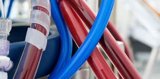 HeartCentennial's tweet photo. Centennial Heart is part of a large network of care including multidisciplinary teams and interconnected hospitals.  This network can quickly and efficiently be engaged in the life-saving care of critically ill patients which can include ECMO. Video:   
https://t.co/tOVvjEfVd9 https://t.co/2EhlqFJY82