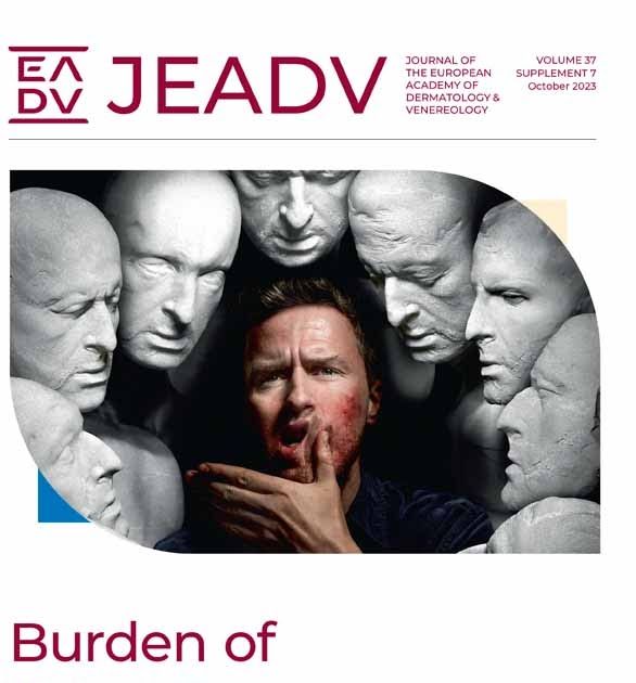 Aller_MD's tweet image. #Quality of #life and #stigmatization in people with #skin #diseases in Europe: A large survey from the ‘burden of skin diseases’ EADV project. Open Access. buff.ly/3QhlVDm