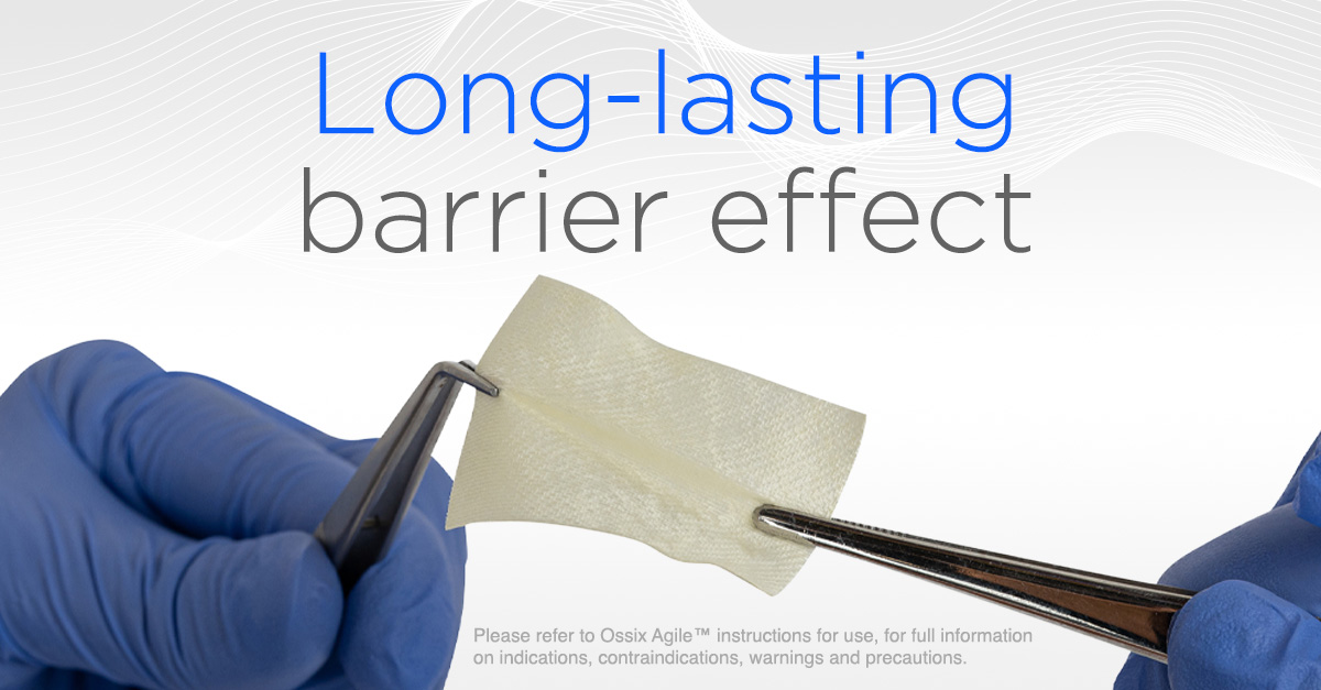 DentsplySirona's tweet photo. Introducing a new approach to bone & soft tissue regeneration. OSSIX Agile™ delivers excellent handling and maintains barrier functionality for 4 to 6 months. Learn More: https://t.co/XgnXzcPMvw
#OSSIX #dentistry #implantdentistry #dentalcare #implantmembranes https://t.co/Z8hj7wPP24