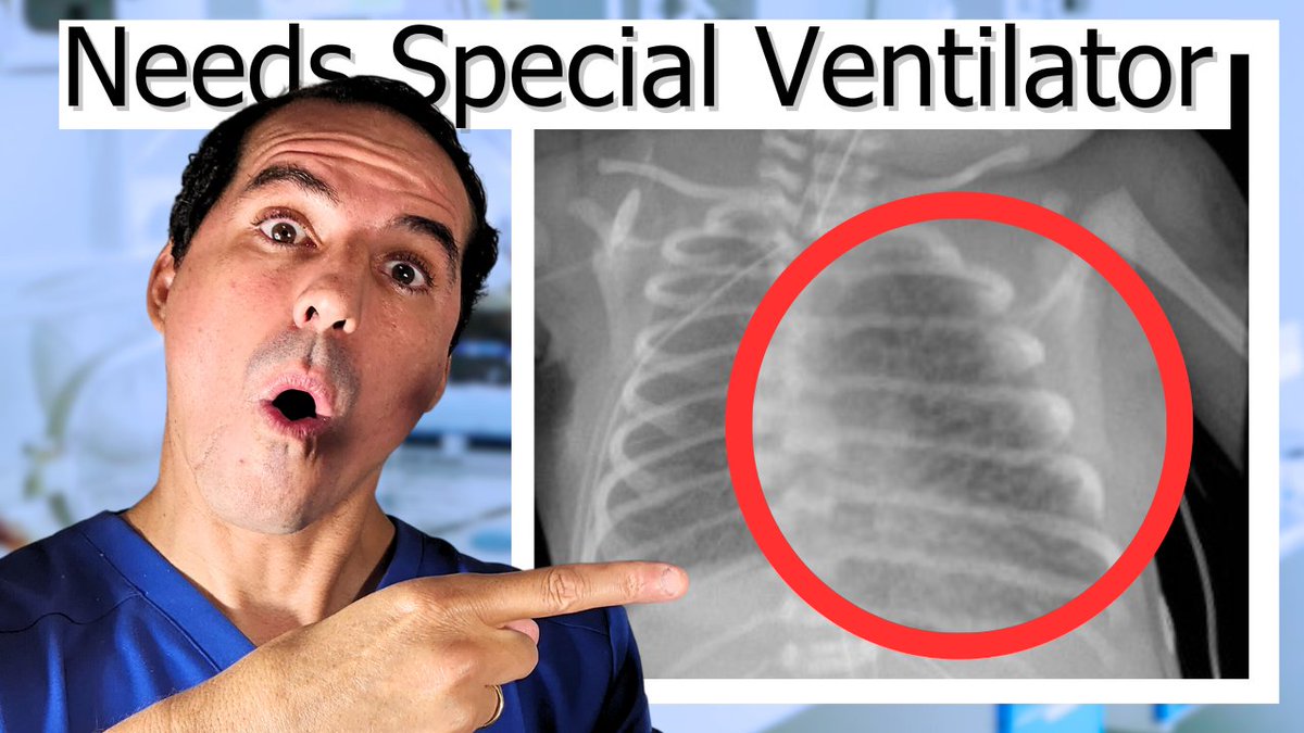 Understanding the Jet and why we use it for PIE (pulmonary interstitial emphysema. Click on the link below!

youtu.be/dFcsqZQ2CZc