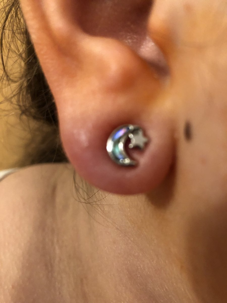 Christopher J. Colombo, MD (@colombocj1) on Twitter photo Best use for expired CVL kit! CriticalCareDad bonding with teenage daughter- got the ears pierced in time for the homecoming dance! Lidocaine, Chlorhexidine, multiple needle gauges- this kit has everything š¤£#criticalcaredad #MedTwitter #sccm <a href="/mount_md/">Cristin Mount, MD</a> <a href="/ADVISSOR_One/">Jeremy</a> <a href="/chungk1031/">Kevin K. Chung, MD</a> Best use for expired CVL kit! CriticalCareDad bonding with teenage daughter- got the ears pierced in time for the homecoming dance! Lidocaine, Chlorhexidine, multiple needle gauges- this kit has everything š¤£#criticalcaredad #MedTwitter #sccm <a href="/mount_md/">Cristin Mount, MD</a> <a href="/ADVISSOR_One/">Jeremy</a> <a href="/chungk1031/">Kevin K. Chung, MD</a>