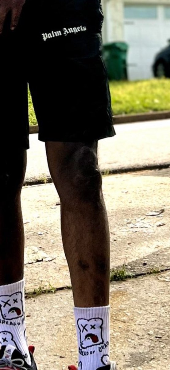 LeLeisthename's tweet photo. Zooming in on my ass you need to be worried about your knees 🤢 https://t.co/T4uy6j5WYx