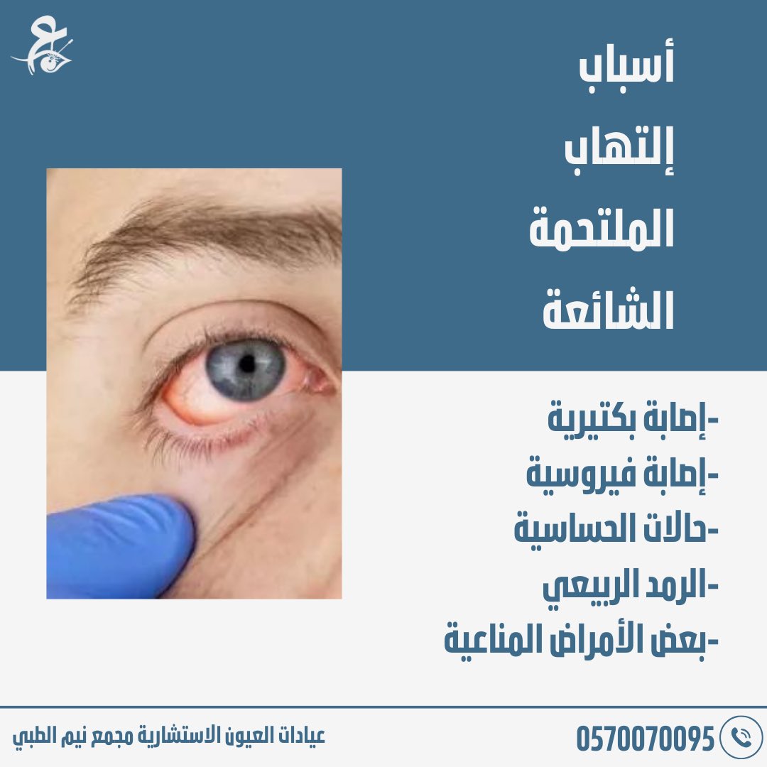 EYECONSULTATION's tweet photo. التهاب الملتحمة المزمن https://t.co/j1DmUQhYiu