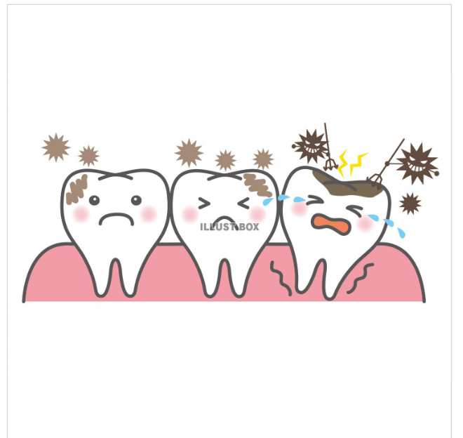 dental55go's tweet photo. 虫歯があるけど様子みましょう　と言われたけど　いいの？？
NOTE記事
https://t.co/QEaUMHNOQr

問題：虫歯がどの大きさになると治療を行うか？
https://t.co/J4yBhWWBgK

う蝕治療ガイドラインhttps://t.co/U52XaOoZcY
歯科衛生士う蝕管理
https://t.co/WF5o2YYne6
虫歯の本
https://t.co/hdBrUKlWKd https://t.co/wFqbJAWWCr