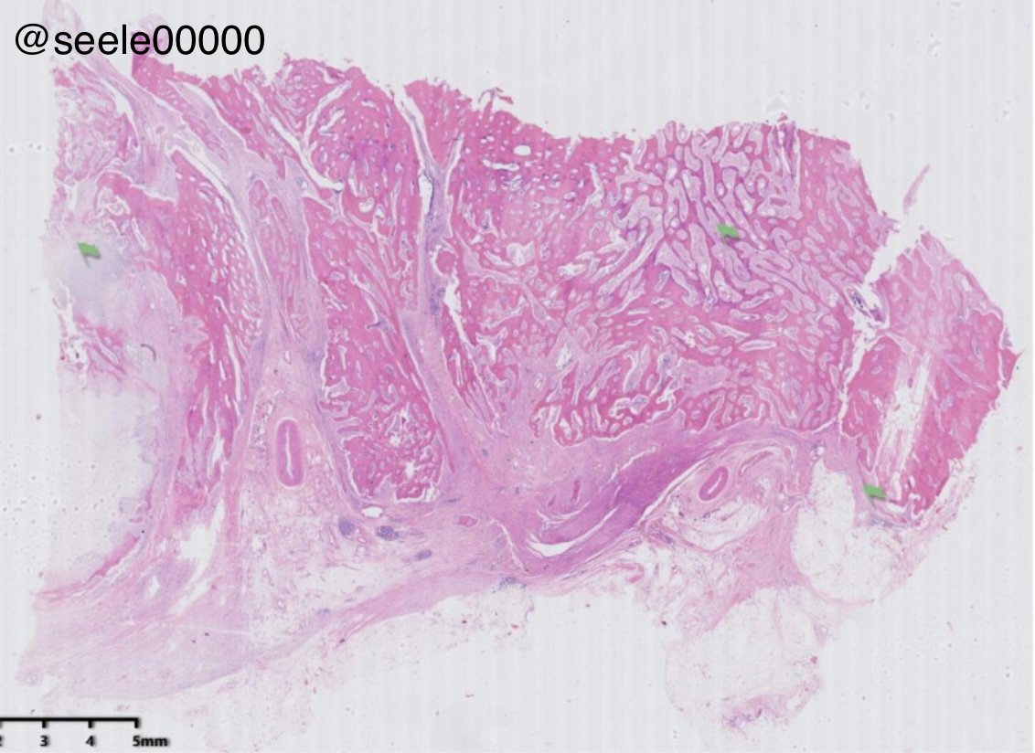 DrHou_pathology tweet picture