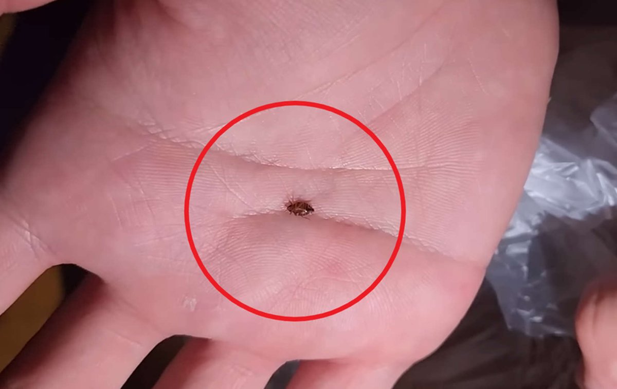 인천 한 찜질방에서 발견된 프랑스 빈대라고 합니다. 헐~~요즘에도 빈대가 있다니 정말 놀랍네요. 찜질방 가기가 두렵네요.ㅠ