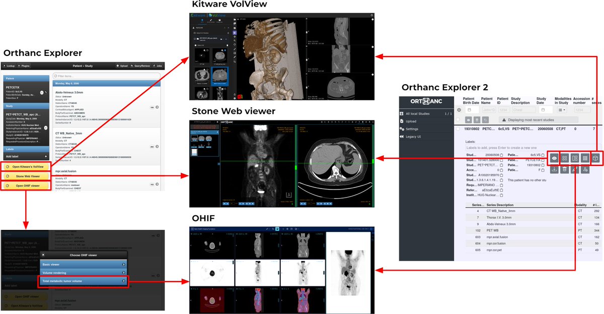 At 1pm at #EuSoMII2023, I'll explain the seamless integration of the Orthanc DICOM server with the Stone Web viewer, Kitware VolView, and OHIF. Feel free to get in touch with me if you want a demo! tx <a href="/EuSoMII/">EuSoMII</a>