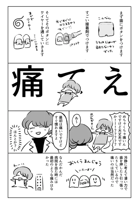 大人になって100万円で歯列矯正した話(4/4)