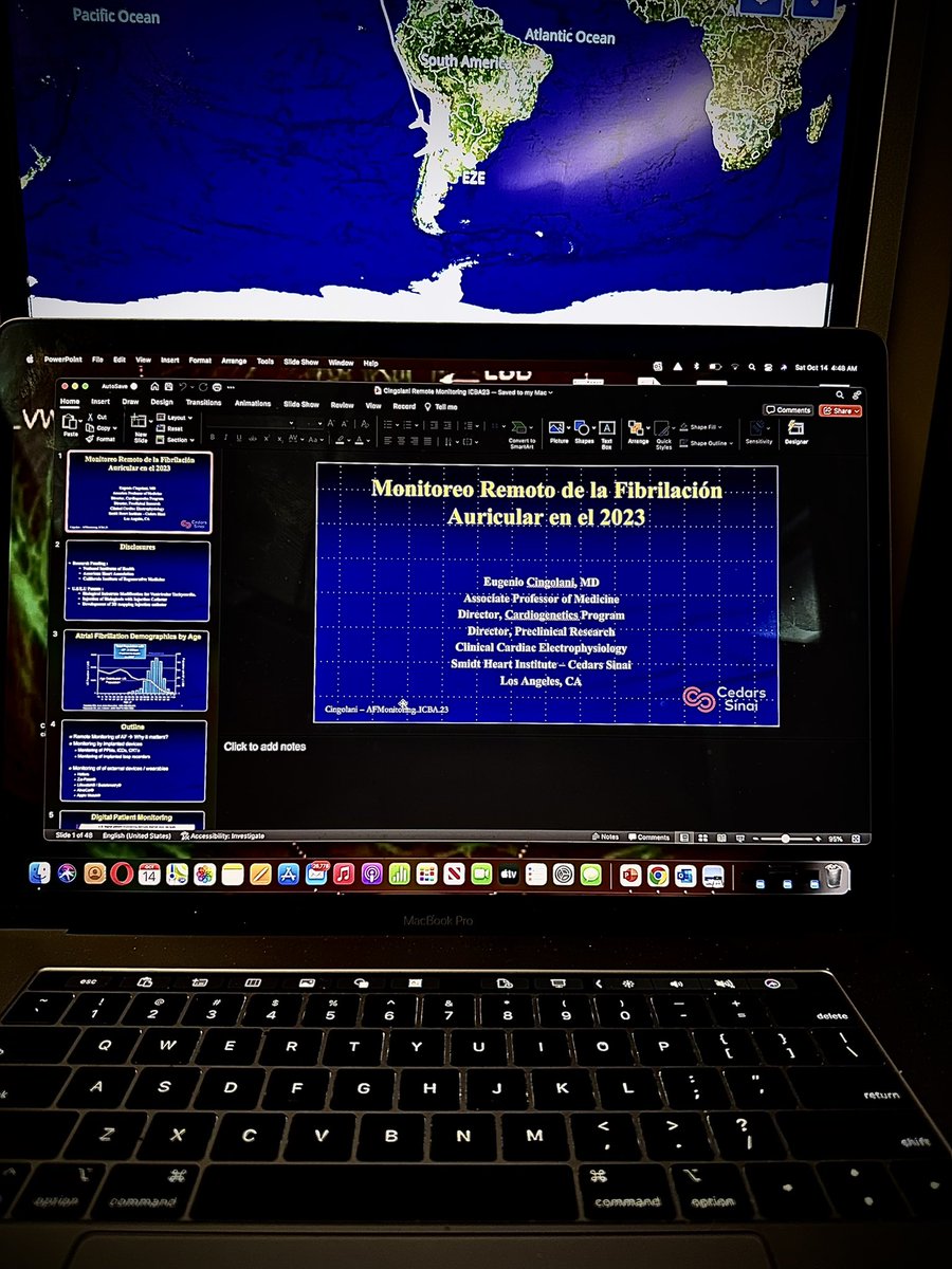 EugenioCingolan's tweet photo. 🛬🇦🇷🇦🇷 #PreCongresoICBA23 ➡️ Remote Monitoring of #AtrialFib #MonitoreoRemoto #AtrialFib #EP #GlobalEP @LaRural_BsAs @SAC_54 @SmidtHeart @CedarsSinaiMed https://t.co/VdrrWdVkTo
