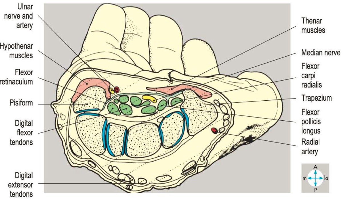 physio_clinics's tweet photo. 💡مقطع عرضي تشريحي جميل لمتلازمة النفق الرسغي (Carpal Tunnel Syndrome) ✋👌 https://t.co/8fw0uFCdRv