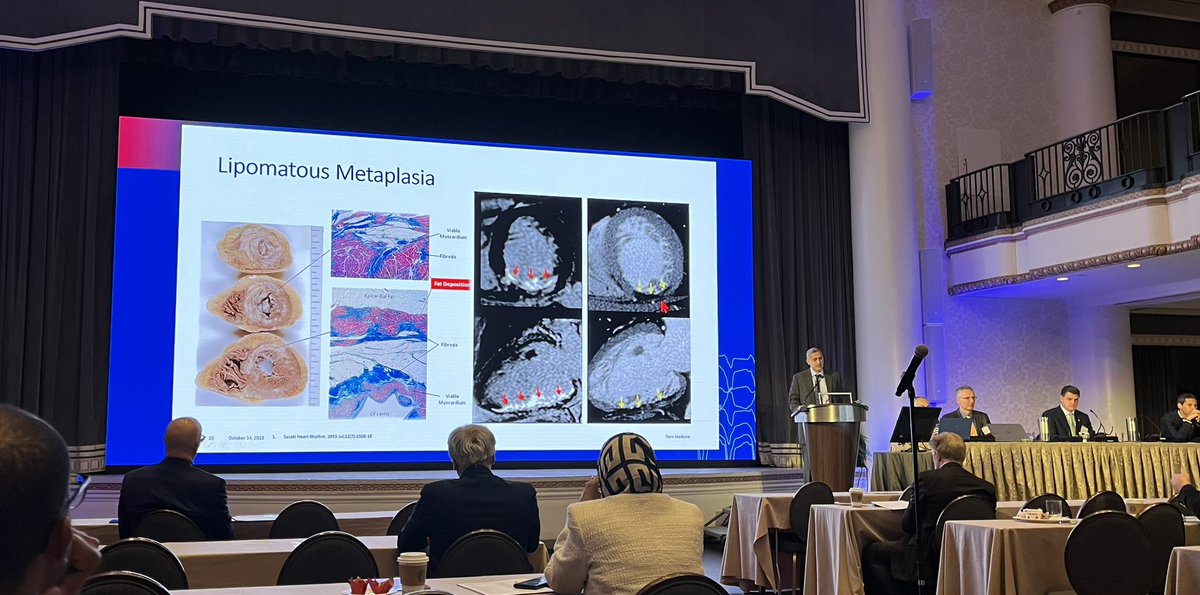 Wow, amazing thoughtful session on imaging in #AblateVT @VTSymposium @Dr_Nazarian_EP @JRWinterfield @Davilandre @FredSacher_EP