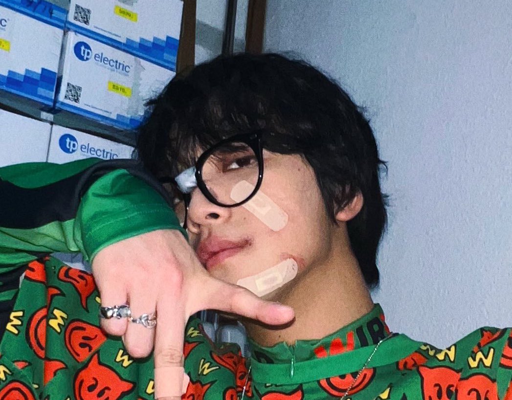 noxx_nox's tweet photo. 하 진짜 밴드 덕지덕지 붙이고 상처분장한 얼굴 오타쿠를 자극함 https://t.co/Q7qpbVcBKK