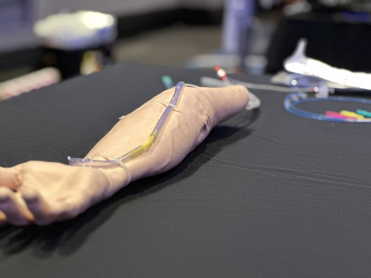KrishnanAmrish's tweet photo. Day 1 of the Asia Pacific Society of Dialysis Access #APSDA/ @ANZSN meeting in Cairns, Australia. Ingenuity with limited resources #InterventionalNephrology. Stoked to be here! https://t.co/LFg0CHJZXZ