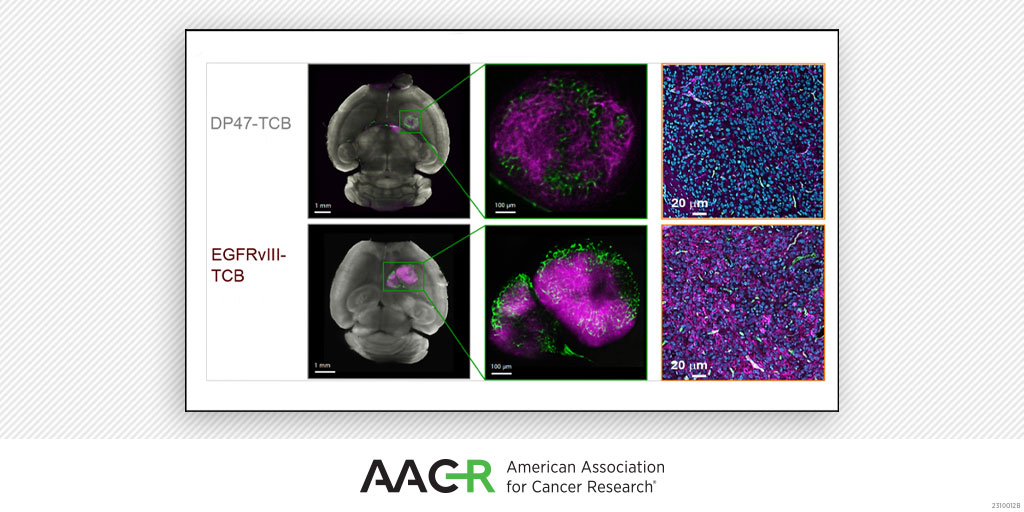 CR_AACR's tweet photo. Attending #AACRbc23?
Read the Brain Cancer article collection.
https://t.co/7pg7Iw9XeY
@AACR https://t.co/G97apADHil