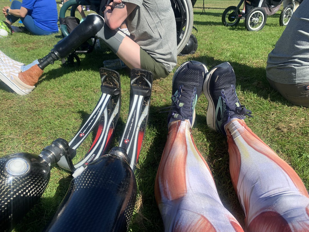 Dr_PhoebeSW's tweet photo. I had a blast volunteering at the @CAFoundation @OssurCorp #RunningClinic today! Incredible to see old friends and make new ones! 🦿🦾❤️@RadyDocs
Proud to represent @radychildrens #LimbClinic https://t.co/pnL9BkAZ4c