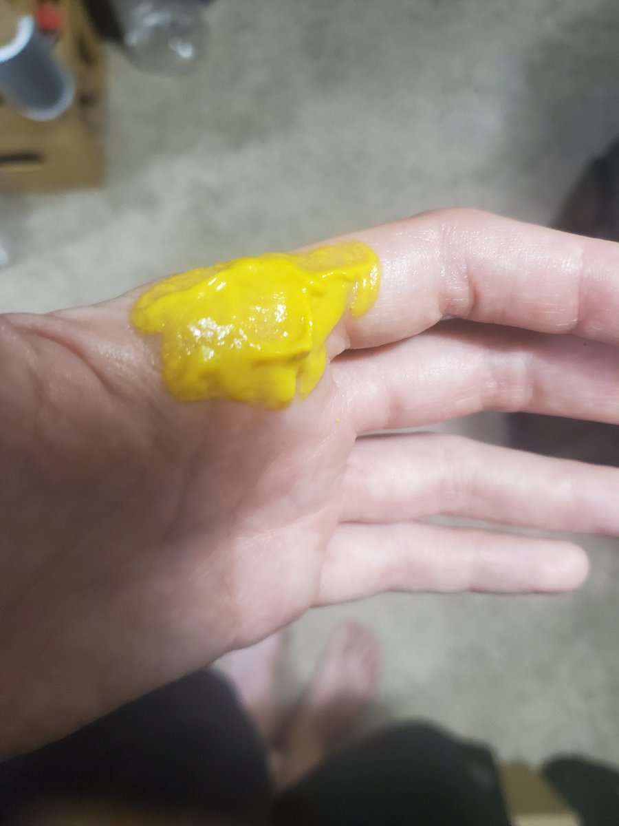 Misstreegrl's tweet photo. Burned myself and this shit isn't working. What other remedies ya got? https://t.co/AILrcFqrlZ