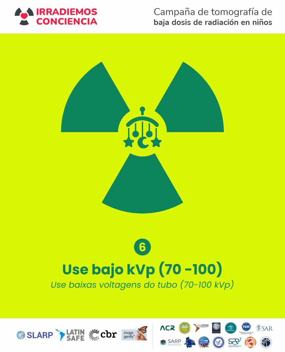 Aumentar el kVp aumenta la energía y da lugar a un haz de rayos X más penetrante. Un kVp más bajo disminuye la dosis del paciente.

¡Sumate a la Campaña ❤️☢️ IRRADIEMOS CONCIENCIA!

Ayúdanos a difundir los 12 consejos didácticos: slarp.net/irradiemos-con…