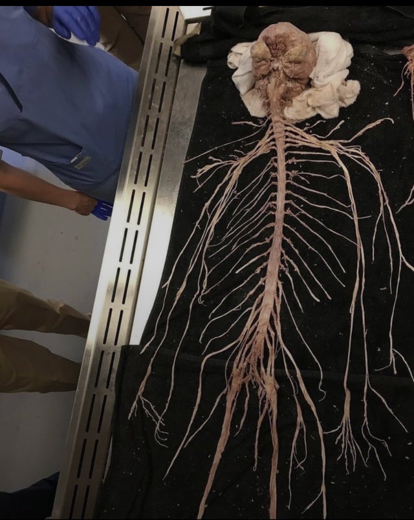 Voici un système nerveux humain extrait