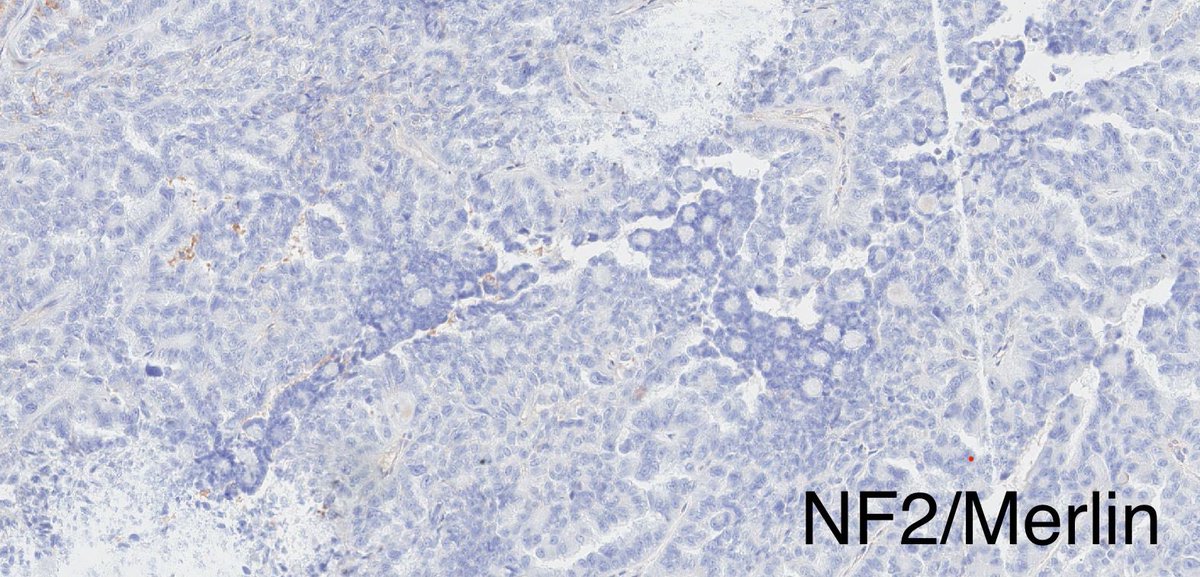 Katrina Collins, MD || Pathologist tweet media