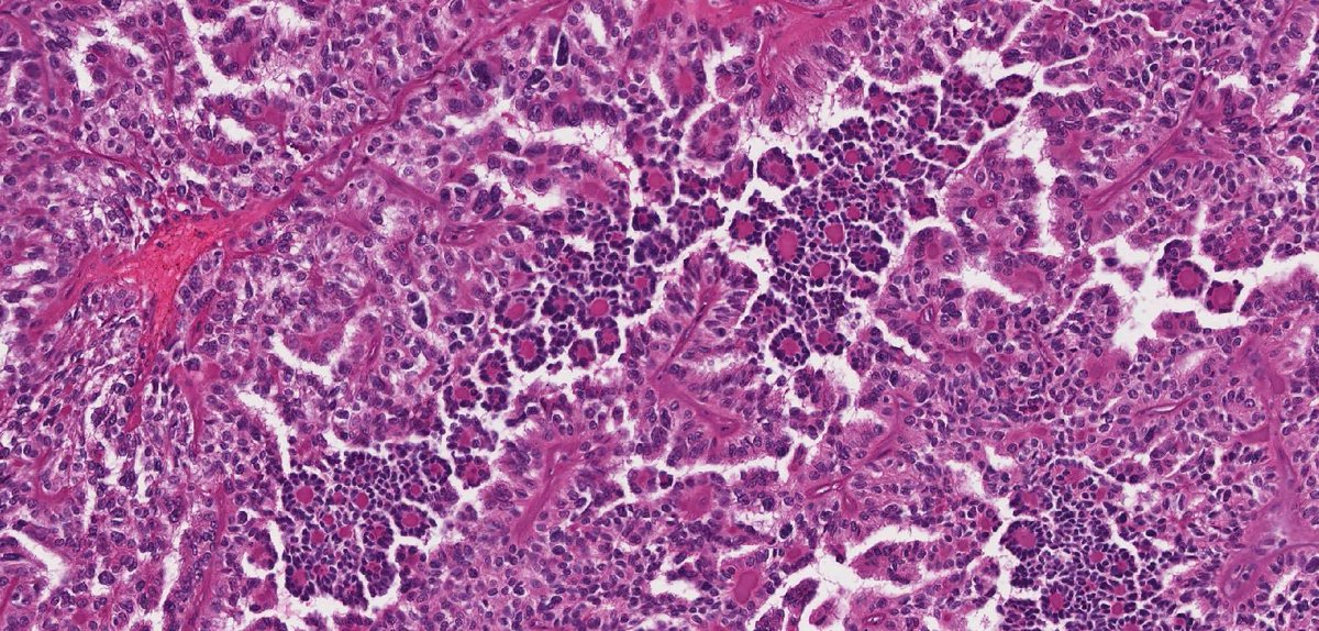 Katrina Collins, MD || Pathologist tweet media