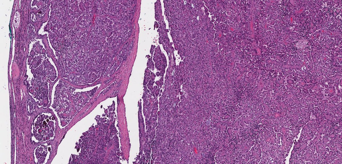 Katrina Collins, MD || Pathologist tweet media