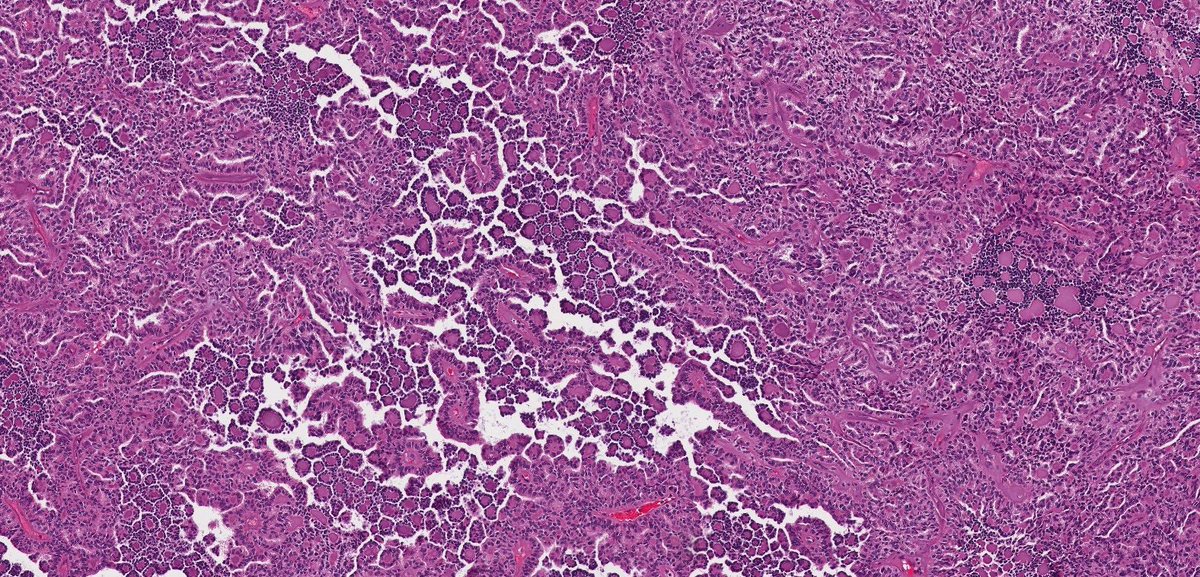 Katrina Collins, MD || Pathologist tweet media