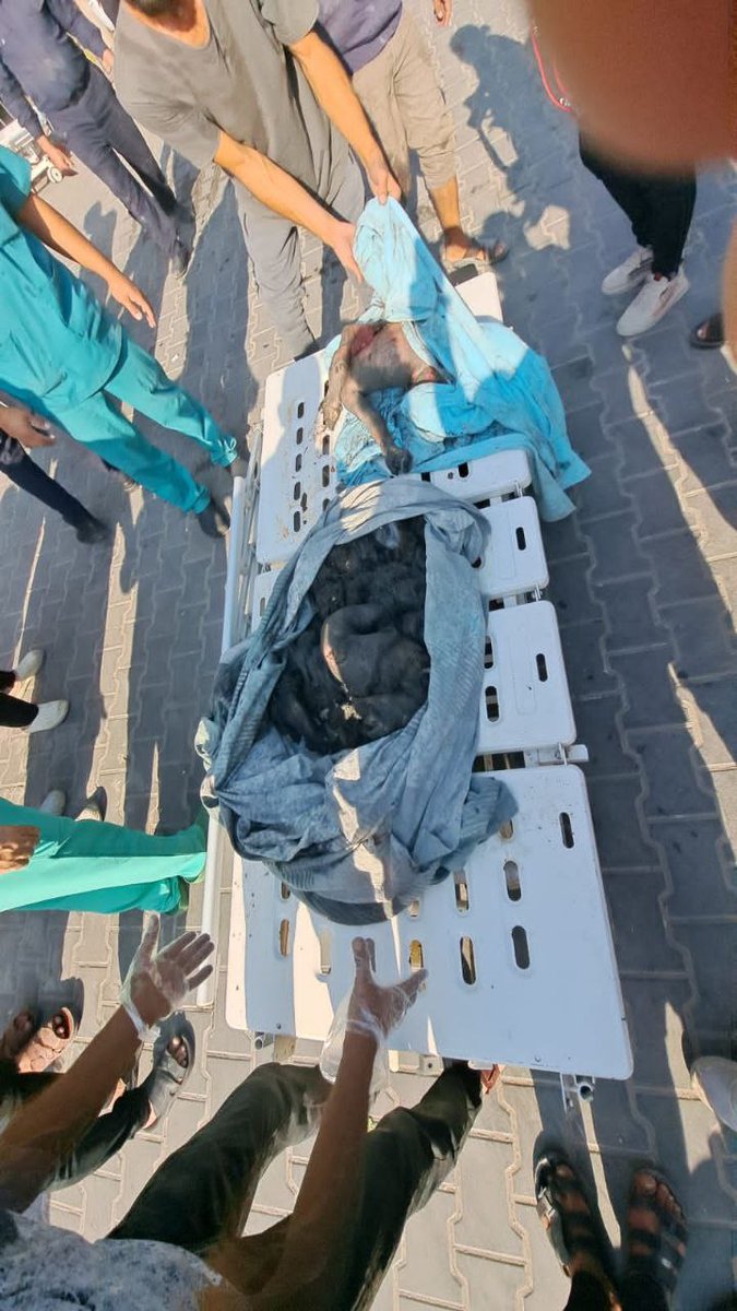 BahaaBhusaif's tweet photo. and genocide on more than two million Palestinians in Gaza.
So far, more than800 children and more than400 women have been killed in Gaza.
What European hypocrisy! #غزه_تحت_القصف_القدس_تنتفض #علامات_الظهور #Isarael #طوفان_الاردن #جمعة_طوفان_الأقصى #فلسطين_تقاوم #IsraelTerrorists https://t.co/zhbVcJTaU3