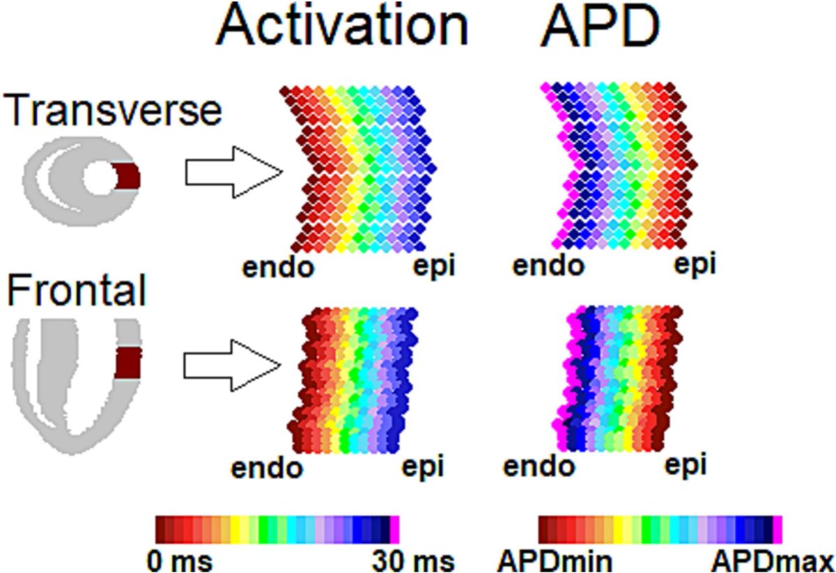 Action potential morphology affects t-wave symmetry (simulation study) #JECG #NewOnline sciencedirect.com/science/articl…