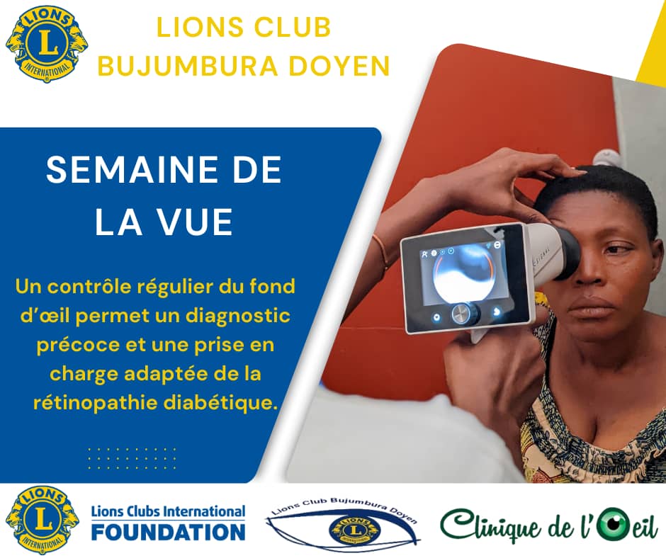 RDiabetique's tweet photo. _SEMAINE MONDIALE DE LA VUE_ : J6 
"Un contrôle régulier du fond d’œil permet un diagnostic précoce et une prise en charge adaptée de la rétinopathie diabétique."
@LionsClubBuja 
@LionsD409 
@OeilClinique 
@sarahbuki
@TonyUkety 
@HjFoundations https://t.co/3OLr7XfzAv