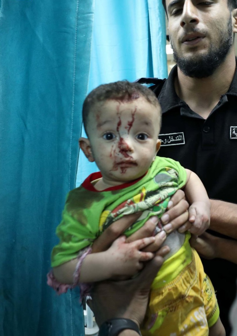 MichaelPterson's tweet photo. Kids?! Really?! Look at Today's crimes done by the Israeli regime in #Gaza:

#IsraeliWarCrimes 
#Isarael 
#Palestine https://t.co/MbQ55ZO98O