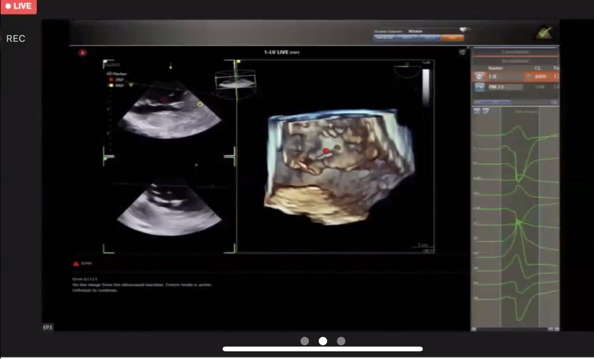 GrupposoVito's tweet photo. #VTsymposium Awesome live cases, QDOT Micro electrodes #NuVision 4D ICE  🤩 https://t.co/Oo94CuIEYp