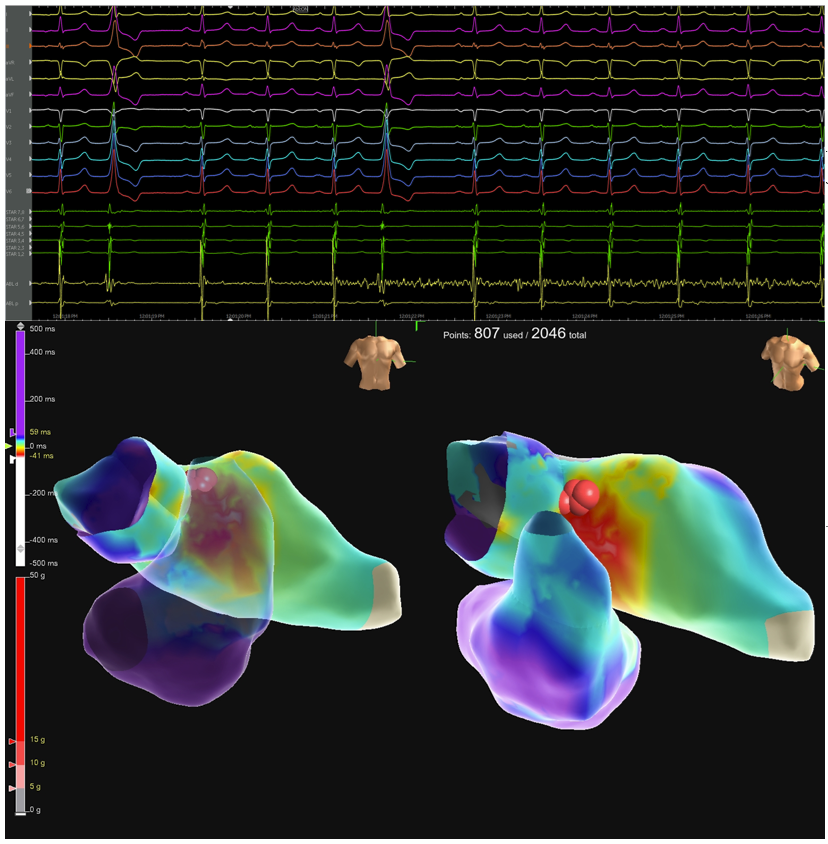 Penn Electrophysiology Fellowship tweet media