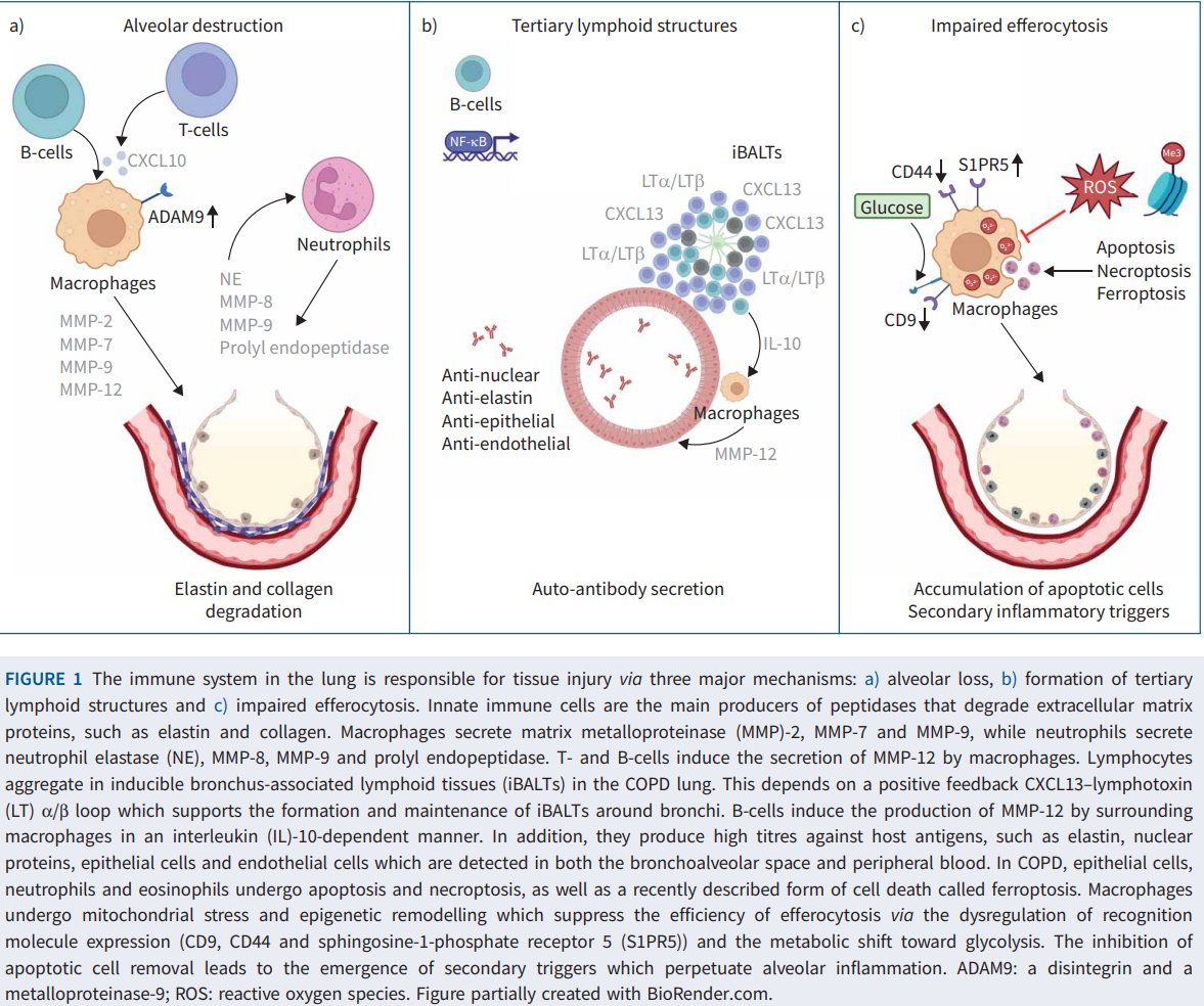 donsin4's tweet photo. What are the main #mechanisms of #COPD pathogenesis? A beautiful review @ERSpublications indicates 3 main pathways. These are the main therapeutic targets for disease modulation. https://t.co/i0DiLYjIkH https://t.co/s8U77IpNLj