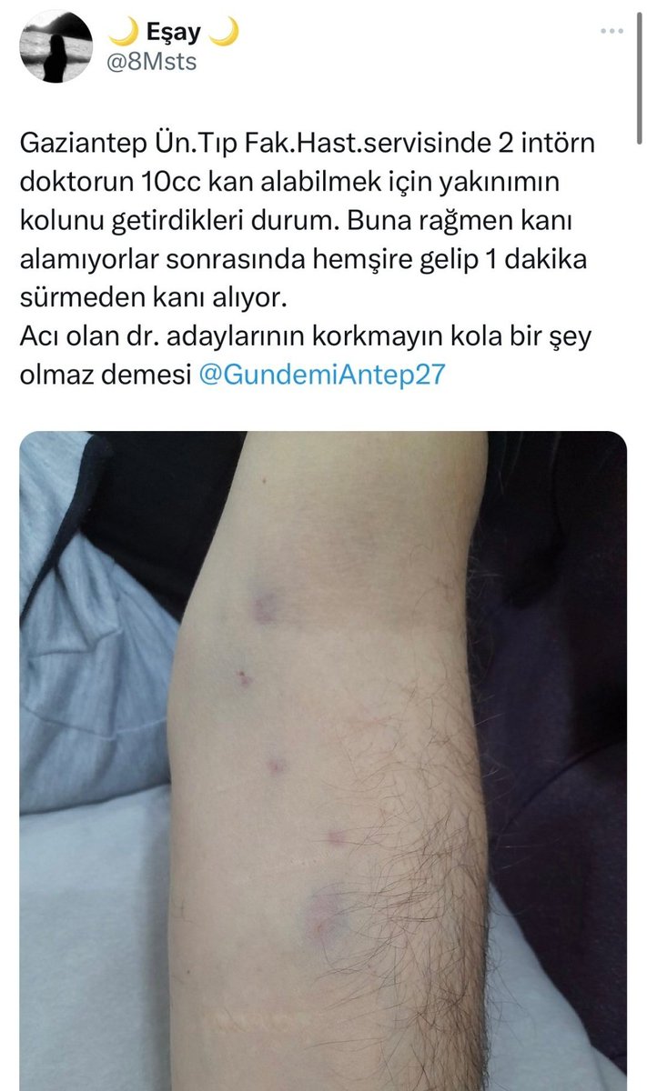 O kol bugün o hale gelsin ki sen 10 yıl sonra beyin ameliyatı olabil