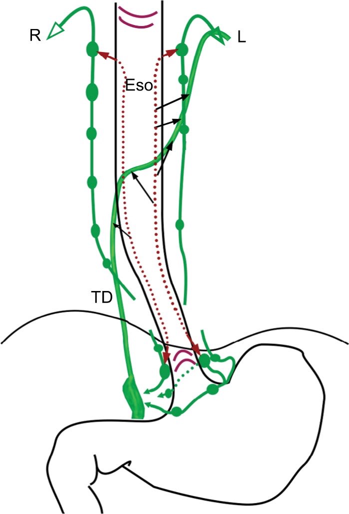 🚨 🚨 🚨 Should cancers of the esophagogastric junction be managed as