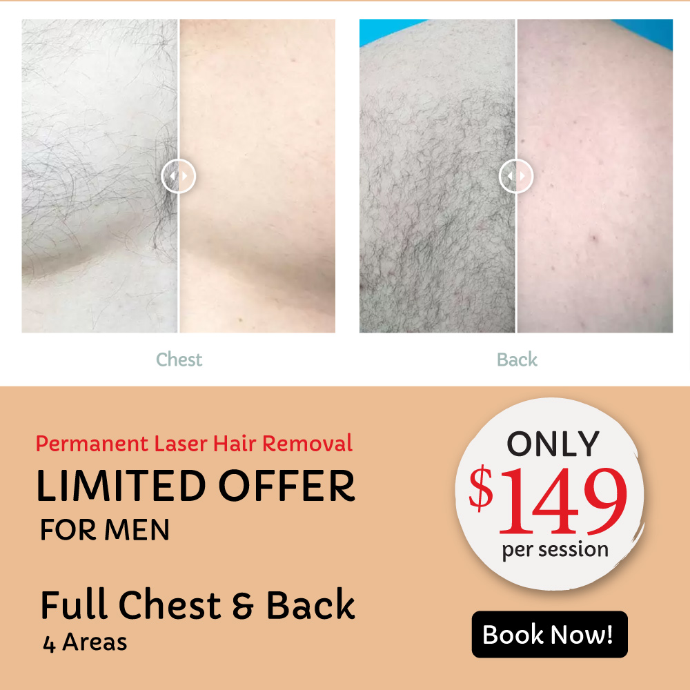 Limited Offer for Men Laser Hair Removal!😎
Full Chest and Back (4 Areas) only $149/session.🤩
Book your Appointment Today
#laser360medspa #laserhairremovalformen #laserhairremovaltoronto