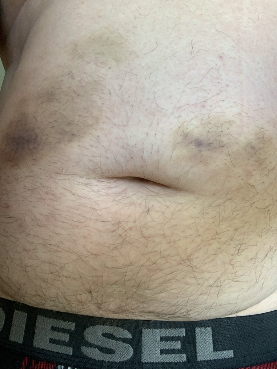 Christopher Atkinson bert480 tweet media