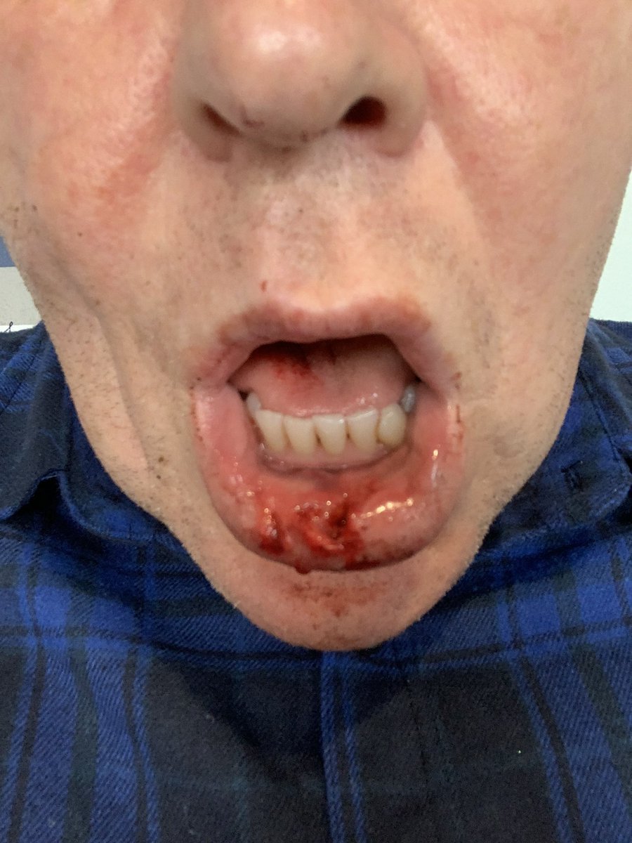 Christopher Atkinson bert480 tweet media