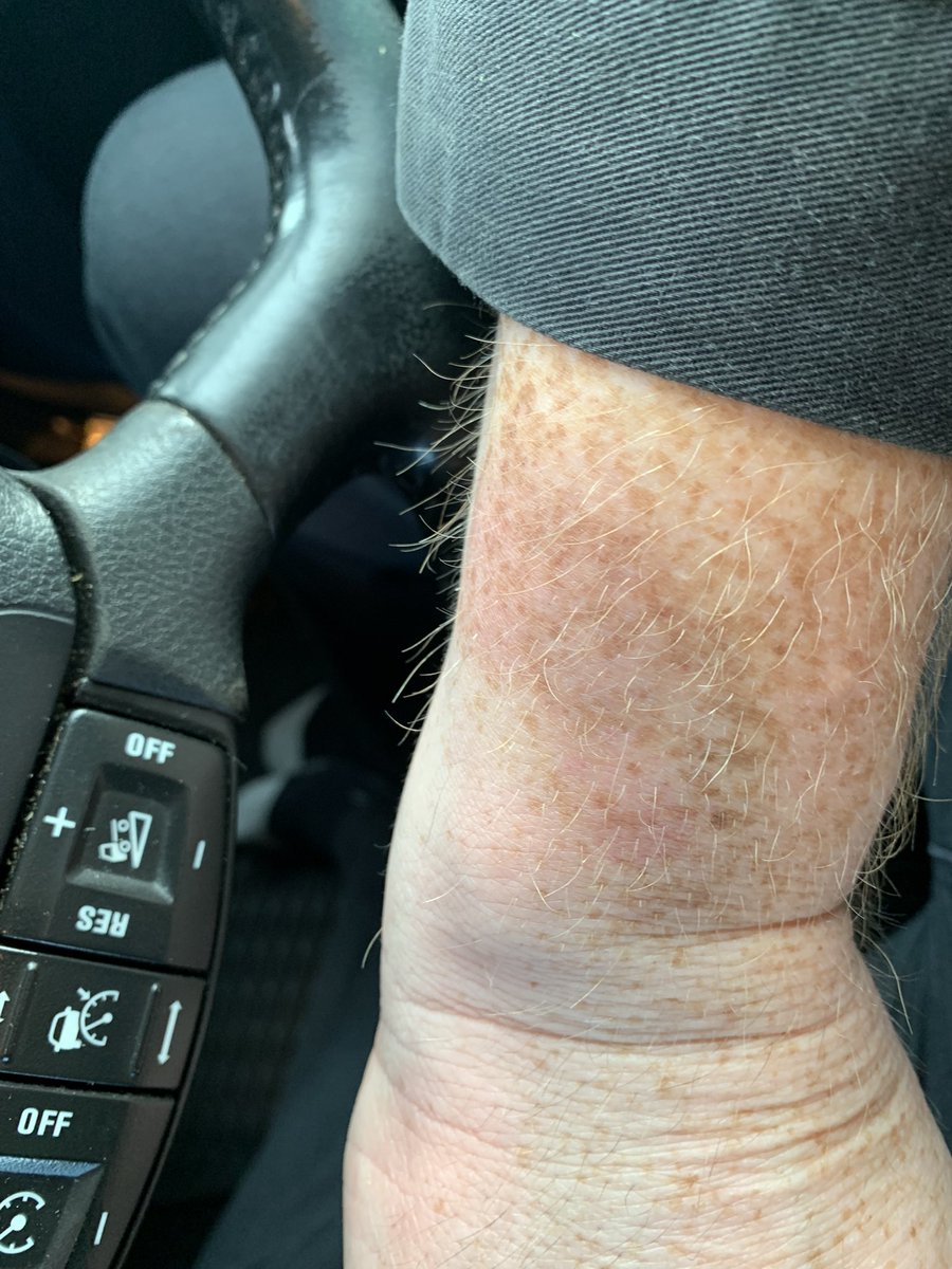 Christopher Atkinson bert480 tweet media