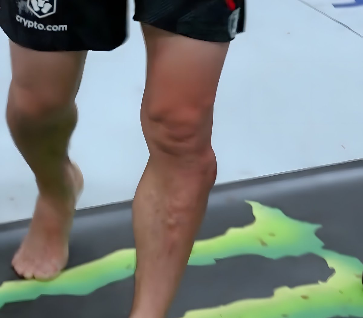 ucantcagethis's tweet photo. Chris gets the WIN with these uncaged (50+) leg kicks from @CGutierrezMMA vs Alatengheili ... OOF. Legkick TKO achievenment badge holding up.  #UFCVegas81 https://t.co/LEmDxljD29