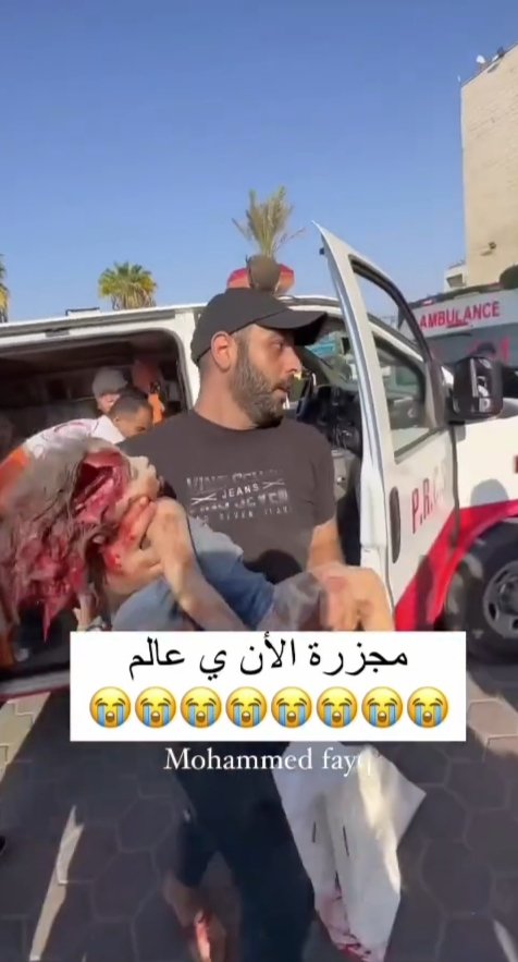 ayoshaail13's tweet photo. israel continues to maim and slaughter the children of gaza in front of the whole world. injured and  dead Palestinian children just keep filling up the hospital #Gazagenocide #GazzeUnderAttack #GazaEvacuation #Gaza https://t.co/JuywYAo0G4