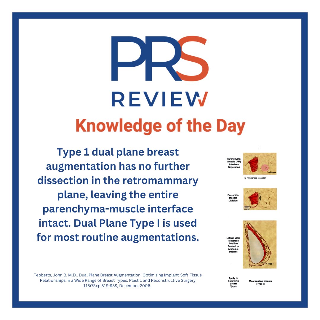 prsreview's tweet photo. Dual Plane Breast Augmentation
#prsreview #breastaugmentation #breastsurgery #dualplanebreastaugmentation #dualplane #cosmeticsurgery #aestheticsurgery #plasticsurgery #reconstructivesurgery #surgicaleducation #medicaleducation #meded #plasticsurgeon #surgery https://t.co/2MmhaTFlv2