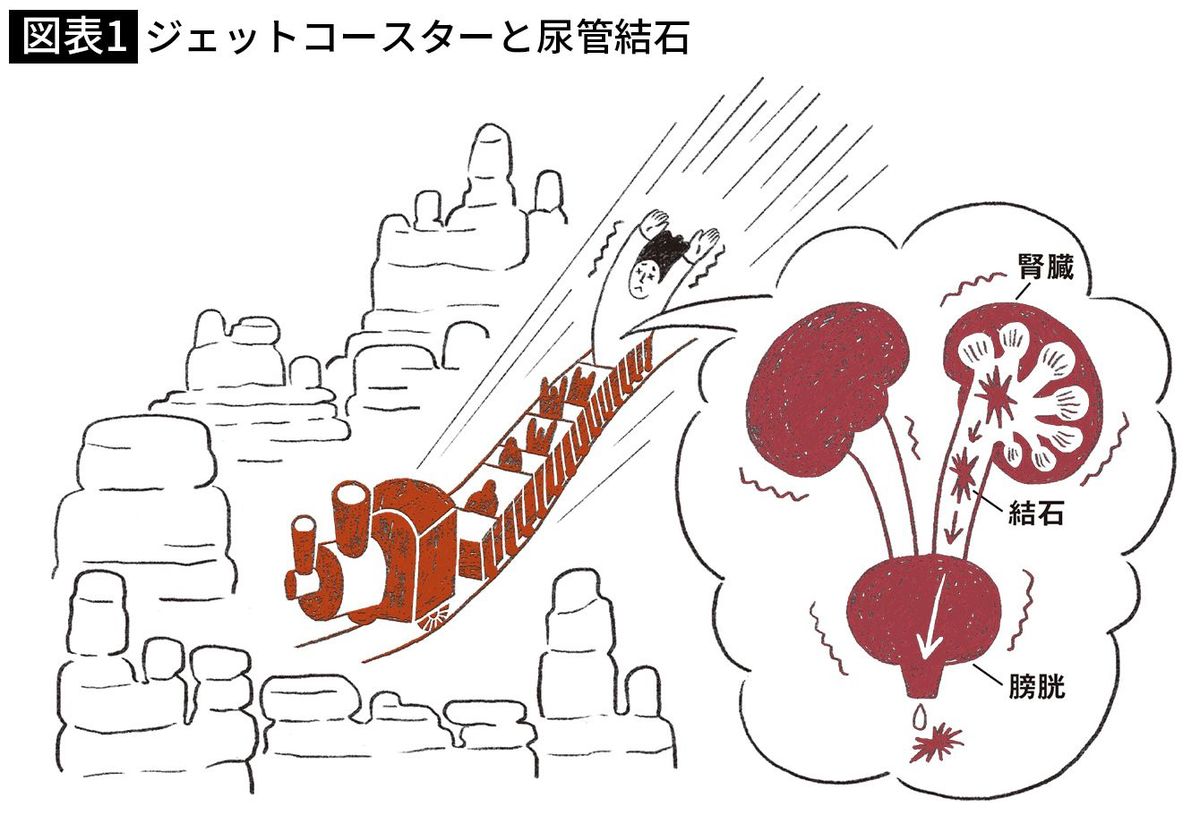 【驚き】米国 ビッグサンダーマウンテンに乗って尿管結石が出た人続出…実験した結果
news.livedoor.com/article/detail…

先頭座席では排石率が12.5％前後であったのに対し、最後部では63.9％の結石が出たそう。尿路が揺さぶられ、振動やGの力を利用して石を動かし、通過を促進して石を出すという考え方。