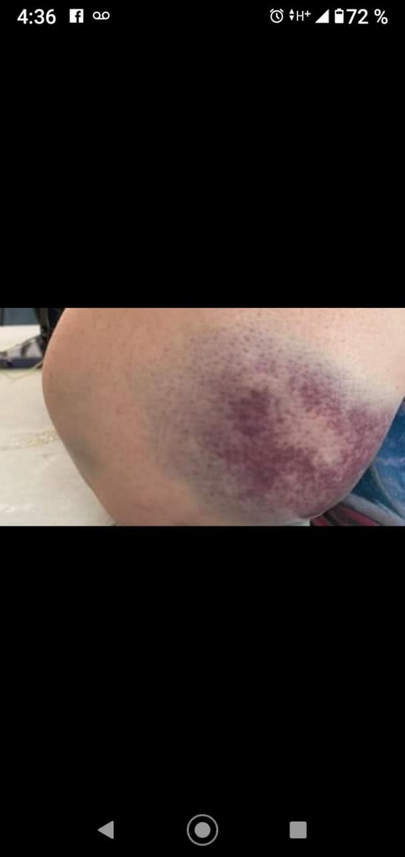 JRZ656MX52's tweet photo. Hilo (1/6) Rt por favor 🙏

La 4t experta en golpear mujeres y más si se trata de víctimas @Almagro_OEA2015 @OEA_oficial @TaniaReneaum @CIDH @hrw @amnesty @amnistiamexico @ONU_es @ONUMX @ONU_derechos @ONUMujeresMX @ACNURamericas @ActualidadRT @LuisaAlcalde @SEGOB_mx @Europarl_ES https://t.co/UomczoiIcJ