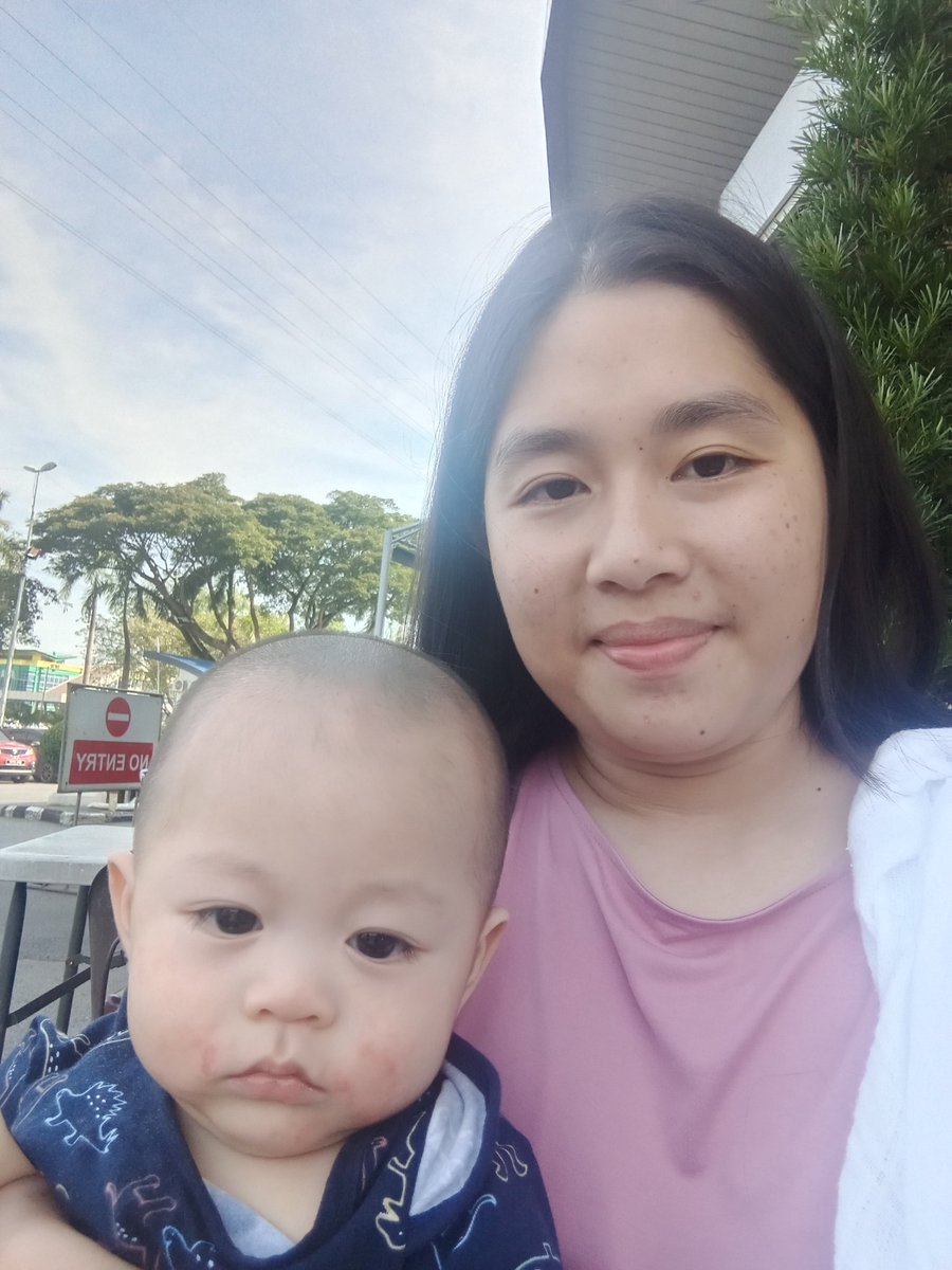 BabyKun6's tweet photo. Abg botak demam.. tumbuh gg satu😊 https://t.co/VPiHkn2Ew5