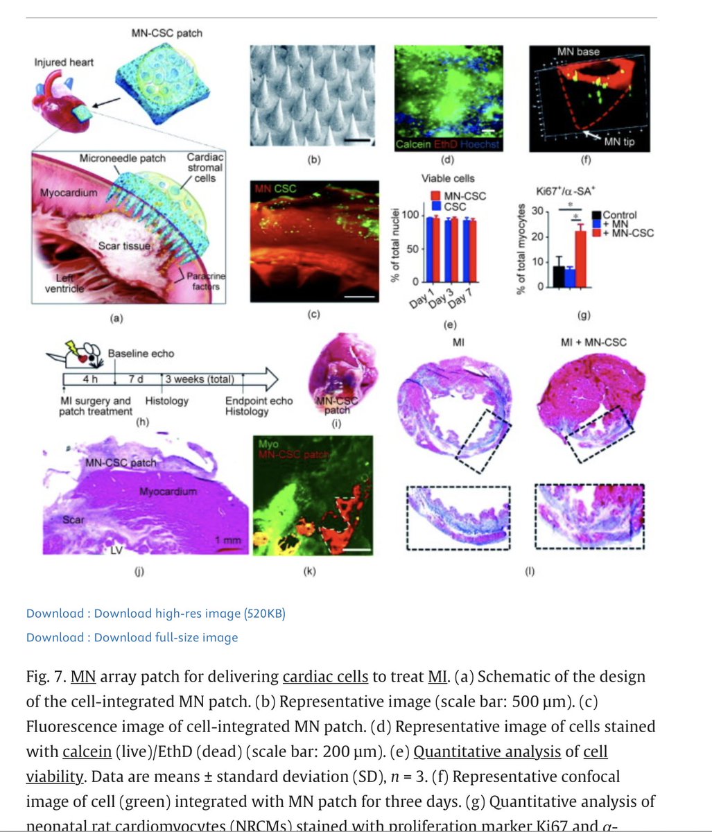 NPeppas's tweet photo. A very "current" article on "Macroencapsulation Devices for Cell Therapy" co-authored by Profs Wei Liu, @guzhenlab &amp; their associates, with @BmeOlivia Lanier and @NPeppas to @UTBiomedical &amp; @TexasChE and Marissa @WechslerLab of @UTSA BME in "Engineering" https://t.co/ydLnMI7am8 https://t.co/1ePZ8V121F