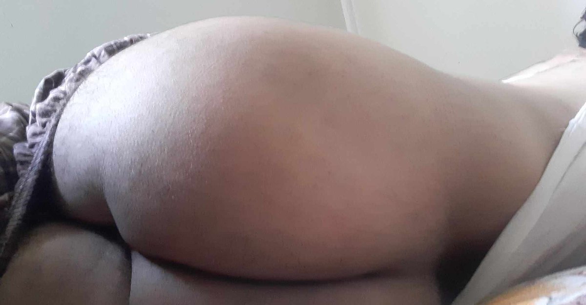 Identity Less tweet media