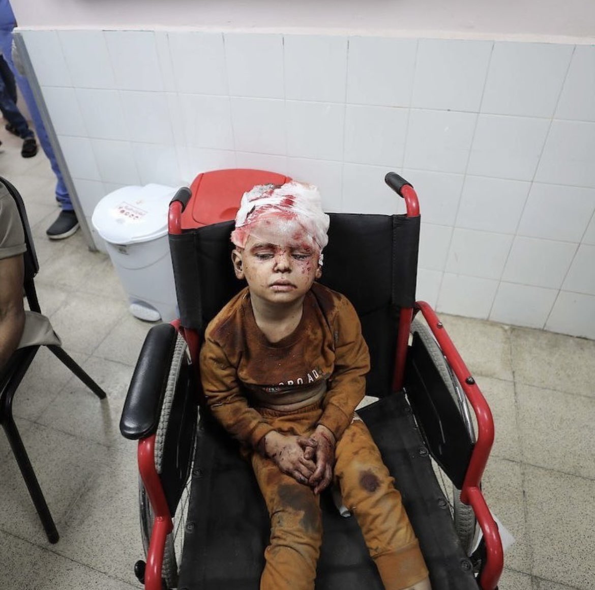 Maha_Saeed6's tweet photo. A child was injured as a result of an 
 Israeli strike in Gaza. The Israeli occupation claims that they are targeting Hamas. Is this child a Hamas fighter?Is he a terrorist?Tell me what is the fault of this child? #Gaza #Gaza_under_attack #FreePalestine #IsraelWarCrimes https://t.co/Yfacb7mCFr